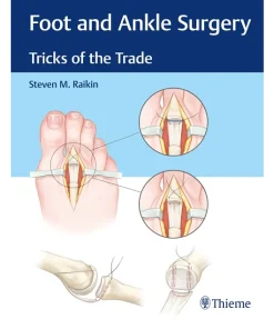 Foot and Ankle Surgery Tricks of the Trade