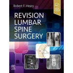 Revision Lumbar Spine Surgery