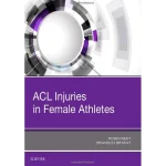 ACL Injuries in Female Athletes