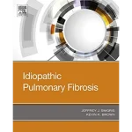 Idiopathic Pulmonary Fibrosis
