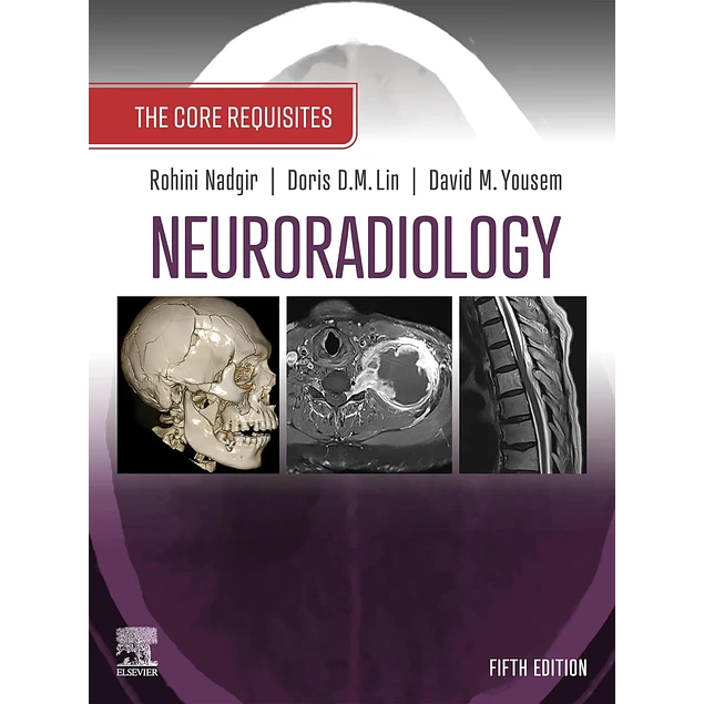 Elsevier Neuroradiology The Core Requisites