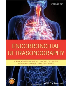 Endobronchial Ultrasonography