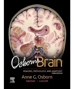 Osborn's Brain