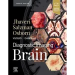 Diagnostic Imaging Brain