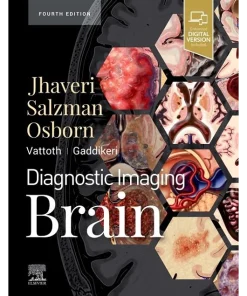 Diagnostic Imaging Brain