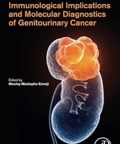 Immunological Implications and Molecular Diagnostics of Genitourinary Cancer