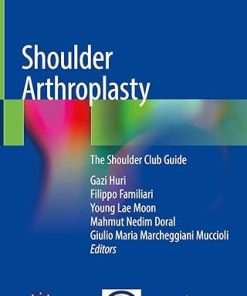 Shoulder Arthroplasty