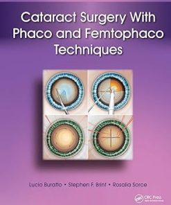 Cataract Surgery With Phaco and Femtophaco Techniques