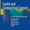 Eyelid and Conjunctival Tumors