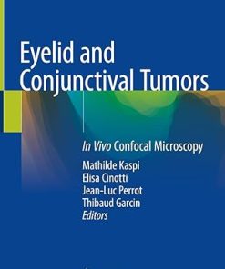 Eyelid and Conjunctival Tumors