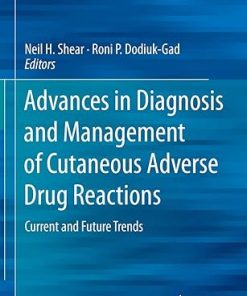 Advances in Diagnosis and Management of Cutaneous Adverse Drug Reactions