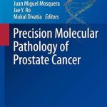 Precision Molecular Pathology of Prostate Cancer