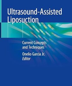 Ultrasound-Assisted Liposuction