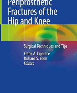 Periprosthetic Fractures of the Hip and Knee