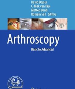 Arthroscopy
