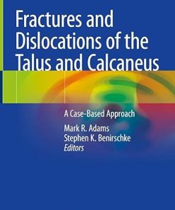 Fractures and Dislocations of the Talus and Calcaneus