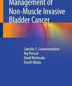 Management of Non-Muscle Invasive Bladder Cancer
