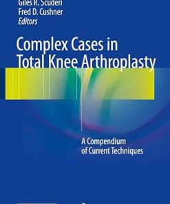 Complex Cases in Total Knee Arthroplasty