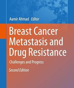 Breast Cancer Metastasis and Drug Resistance