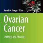 Ovarian Cancer