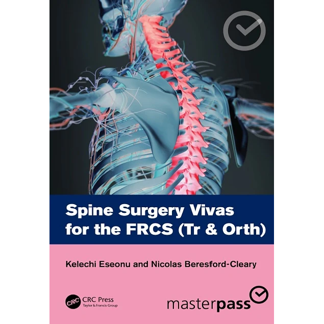 Spine Surgery Vivas for the FRCS (Tr & Orth)