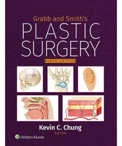 Grabb and Smith's Plastic Surgery