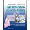Webb Müller and Naidich's High-Resolution CT of the Lung