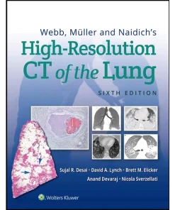 Webb Müller and Naidich's High-Resolution CT of the Lung