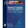 Minimally Invasive Thoracic Surgery