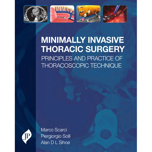 Minimally Invasive Thoracic Surgery
