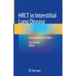 HRCT in Interstitial Lung Disease Instructive Case Studies