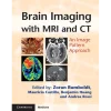 Brain Imaging with MRI and CT An Image Pattern Approach
