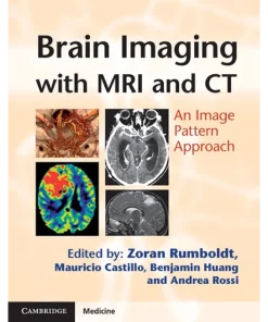 Brain Imaging with MRI and CT An Image Pattern Approach