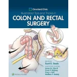 Cleveland Clinic Illustrated Tips and Tricks in Colon and Rectal Surgery