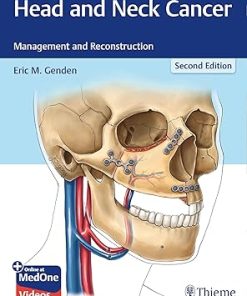 Head and Neck Cancer