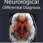 Differential Diagnosis in Neurology