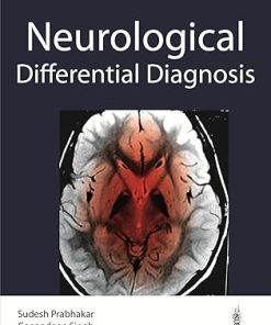 Differential Diagnosis in Neurology