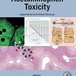 Acetaminophen Toxicity