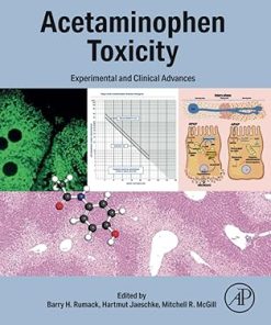 Acetaminophen Toxicity