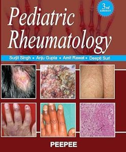 Pediatric Rheumatology
