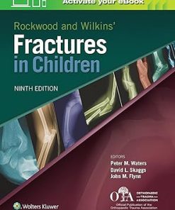 Fractures in Children