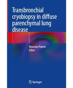 Transbronchial cryobiopsy in diffuse parenchymal lung disease
