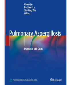 Pulmonary Aspergillosis Diagnosis and Cases