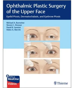 Ophthalmic Plastic Surgery of the Upper Face