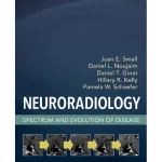 Elsevier Neuroradiology Spectrum and Evolution of Disease