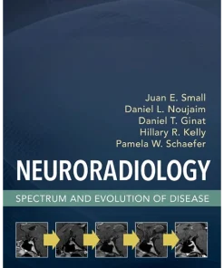 Elsevier Neuroradiology Spectrum and Evolution of Disease