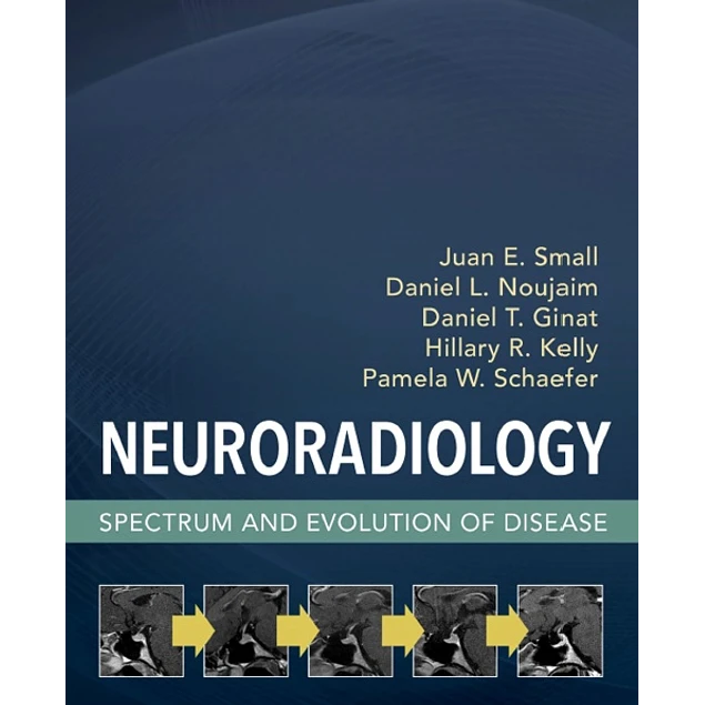 Elsevier Neuroradiology Spectrum and Evolution of Disease
