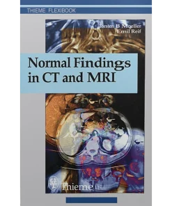 NORMAL FINDINGS IN CT AND MRI