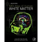 MRI Atlas of Human White Matter