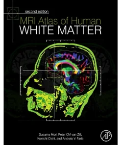 MRI Atlas of Human White Matter